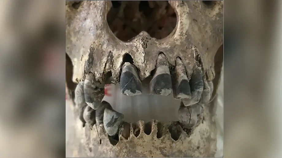 Dentes escurecidos no Vietnã antigo: como comunidades da Idade do Ferro criaram um padrão de beleza que durou 2 mil anos